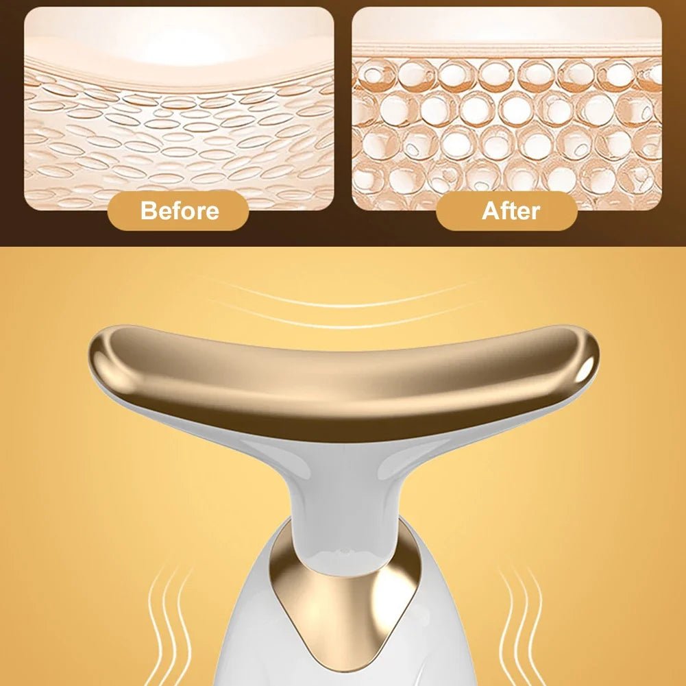 Dolphin Facial Lifter - DASLII